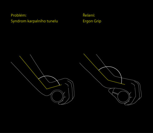 Ergon GP2-S Grip